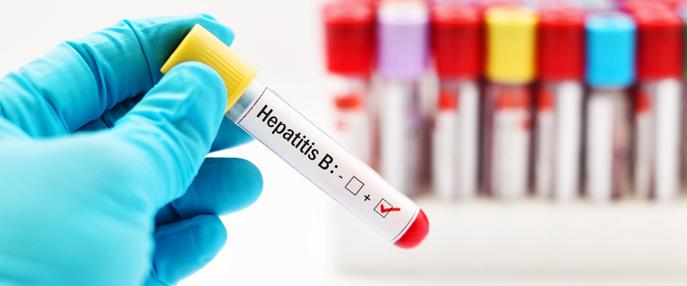 Hepatitis B ndi chiyani? Kodi zizindikiro ndi njira zochizira ndi chiyani?